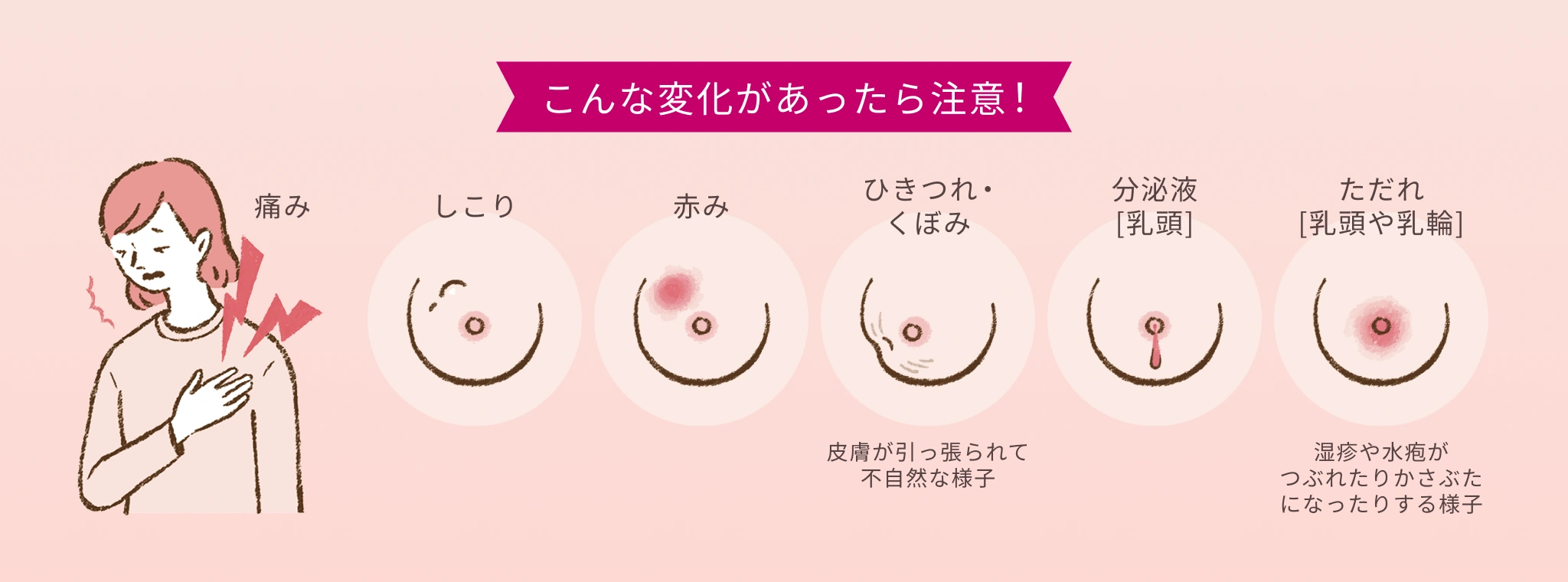 こんな変化があったら注意！痛み・しこり・赤み・ひきつれ･くぼみ（皮膚が引っ張られて不自然な様子）・分泌液［乳頭］・ただれ［乳頭や乳輪］（湿疹や水疱がつぶれたりかさぶたになったりする様子）